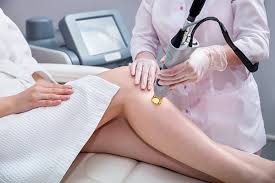 Unveil Your Best Self: Transform Your Skin with Laser Hair Removal at Beauty Empire Aesthetics post thumbnail image