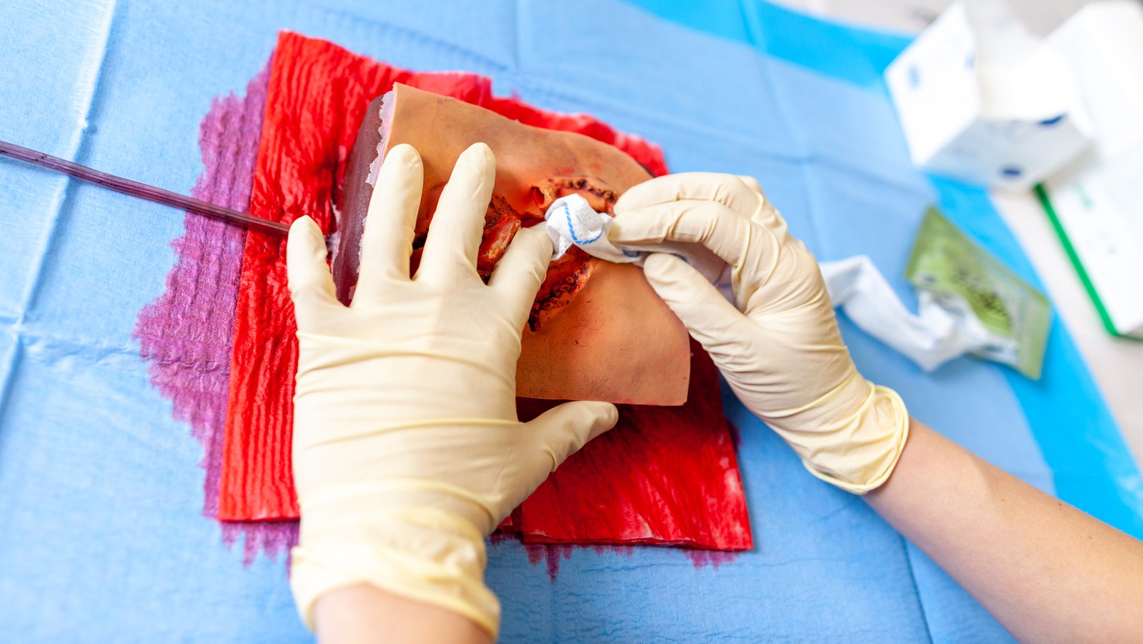 Haemostatic Dentistry Techniques for Efficient Bleeding Control post thumbnail image